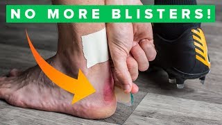 How to never get blisters again  Top 5 blister hacks [upl. by Aipmylo]