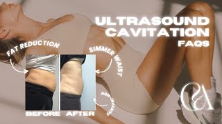 Ultrasound Cavitation Explained Beginners Guide [upl. by Ellenahc]