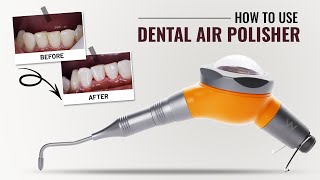 How to use Dental Air Polisher  Waldent Premium Air Polisher [upl. by Samau851]