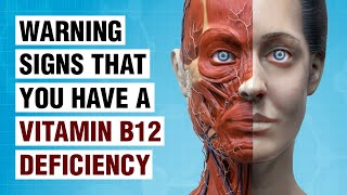 10 Symptoms of Vitamin B12 Deficiency You Should Never Ignore [upl. by Ehcor43]