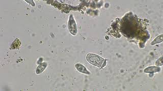 Pond water under Microscope  Ciliate [upl. by Aihsoj]