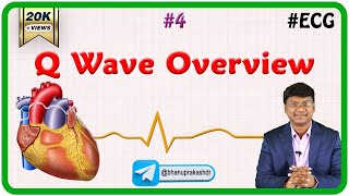 4 Q Wave Overview  ECG assessment and ECG interpretation made easy [upl. by Enilekaj]