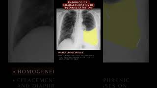 Can You Pass This Quiz Questions and Answers 10 Essential Chest Xrays xray respiratory shorts [upl. by Gnaig]