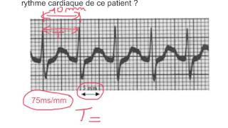 Exploiter un ECG [upl. by Port238]