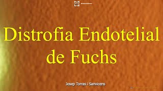 Distrofia Endotelial de Fuchs [upl. by Nitas517]