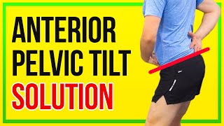 How to Fix Anterior Pelvic Tilt 4 KEY EXERCISES [upl. by Akimahs549]