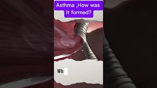 Asthma A 3D Look Inside Your Lungs asthma 3Danimation health lungs breathing [upl. by Burt292]