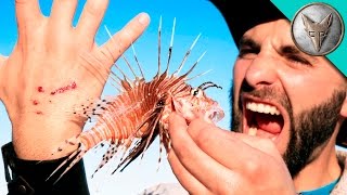 STUNG by a LIONFISH [upl. by Enneite]