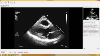 2 Echo Test and Teach Measurement Case [upl. by Kyne]