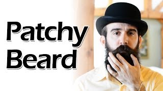 How to Deal with a Patchy Beard [upl. by Gleda]