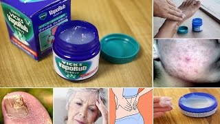 22 Practical Popular Weird amp Wonderful Uses of VICKS VAPORUB [upl. by Ide]