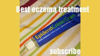 Epiderm cream  How to use Epiderm Cream  uses of Epiderm cream [upl. by Danell722]