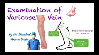 Examination of Varicose Vein for MBBS MS Surgery medical students [upl. by Notelrac]