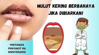 Mulut Sering Kering Ketahui Penyebabnya Ini [upl. by Linetta]