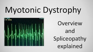 Myotonic Dystrophy and Spliceopathy explained [upl. by Dlareme]