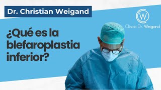 Blefaroplastia inferior en Madrid  DrWeigand  Experto [upl. by Gona]