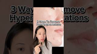 How To Remove Hyperpigmentations [upl. by Ahtiuqal]