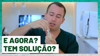 QUEBROU O PARAFUSO DO IMPLANTE E AGORA  DR GUILHERME FELIX [upl. by Soirtemed]