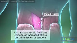 Lower Back Sprain and Strain Reasons [upl. by Ataliah]