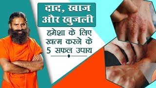 दाद खाज खुजली हमेशा के लिए खत्म करने के 5 सफल उपाय  Swami Ramdev [upl. by Safir]