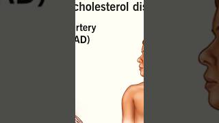 High Cholesterol Ka Risk and Things To avoid shortsviral shortsvideo shorts short ytshortsindia [upl. by Garold795]