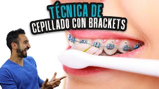 Cómo Cepillarse los Dientes CON BRACKETS Técnica de Cepillado con Brakets Tu dentista de confianza [upl. by Nue]