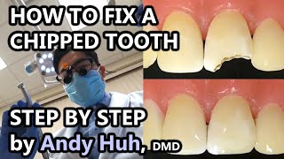 How to fix a chippedbroken tooth dental bonding composite Pasta Evergreen Dental Billerica MA [upl. by Yendahc]