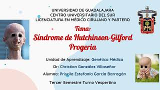 Progeria o Síndrome de Hutchinson Gilford [upl. by Egwan704]