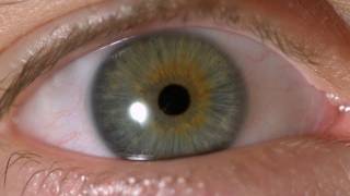 My Iris Wobbles  Eye In Slow Motion [upl. by Kimbell701]