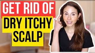 Get Rid Of Dry Itchy Scalp FAST [upl. by Mara316]