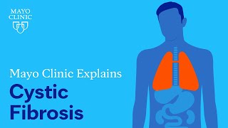 Mayo Clinic Explains Cystic Fibrosis [upl. by Hadnama381]