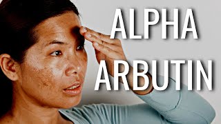 Put Alpha Arbutin On Your Dark Spots amp SEE What Happens [upl. by Alletse]