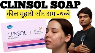 clinsol soap  clinsol soap review in hindi  clinsol soap review  clinsol soap ke fayde [upl. by Reggi815]