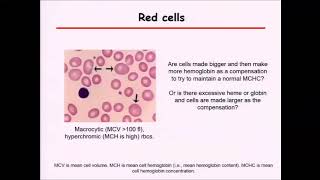 What is MDS myelodysplastic syndrome [upl. by Zerimar185]