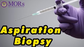 FINE NEEDLE ASPIRATION BIOPSY PROCEDURE [upl. by Kernan]