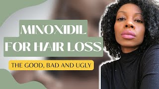 A complete guide to Minoxidil for female hair loss  the good bad and ugly The real tea [upl. by Kinney]