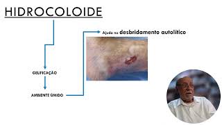 HIDROCOLOIDE Parte 2 [upl. by Dilisio]