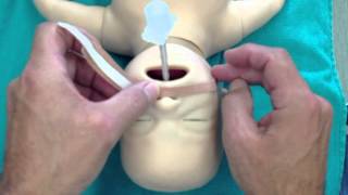 Taping a Neonatal ETT [upl. by Vasos]