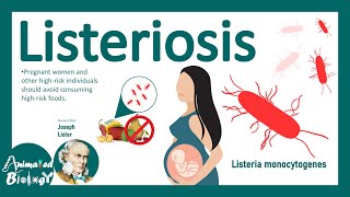 Listeriosis Listeria Monocytogenes  Sources Pathophysiology Symptoms Diagnosis Treatment [upl. by Anippesuig]