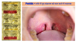 Pentids 400 Tablet Penicillin G or Benzylpenicillin बैक्टीरिया के सेल वाल को ख़तम करने वाली दवा [upl. by Meirrak]