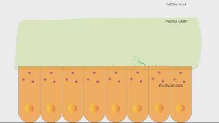 H Pylori and Ulcers [upl. by Nennerb]