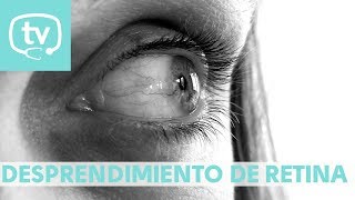 Desprendimiento de retina ¿en qué consiste [upl. by Kermit]