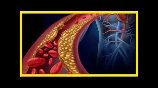 Comment réduire naturellement les triglycérides [upl. by Giusto620]