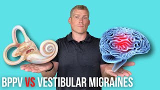 BPPV Vertigo VS Vestibular Migraine [upl. by Anu844]