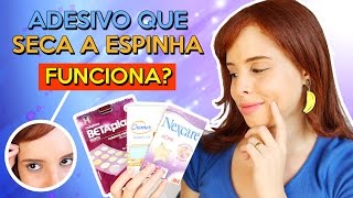 ADESIVO QUE SECA A ESPINHA  Funciona Qual o melhor  DAIENE CALMON [upl. by Bessie]