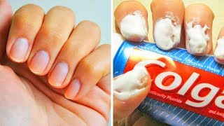 20 einfache Tricks für perfekte Fingernägel [upl. by Midis]