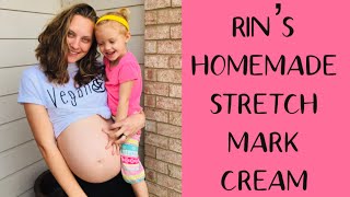 How to Prevent Stretch Marks Stretch Mark Cream Recipe that WORKS  Chemical Free [upl. by Theran]