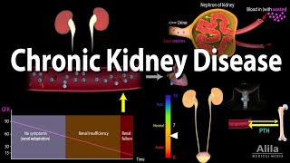 Chronic Kidney Disease Animation [upl. by Neitsirk467]