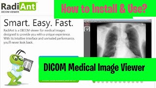 DICOM Images How to download install and use RadiAnt Viewer l ITFO [upl. by Atiuqat]