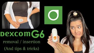 How to change your Dexcom G6 Sensor Tutorial  Dexcom G6 Removal amp Insertion [upl. by Iden253]